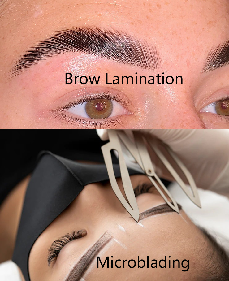 Eyebrow Tattoo Removal | Tattoo Removal Experts